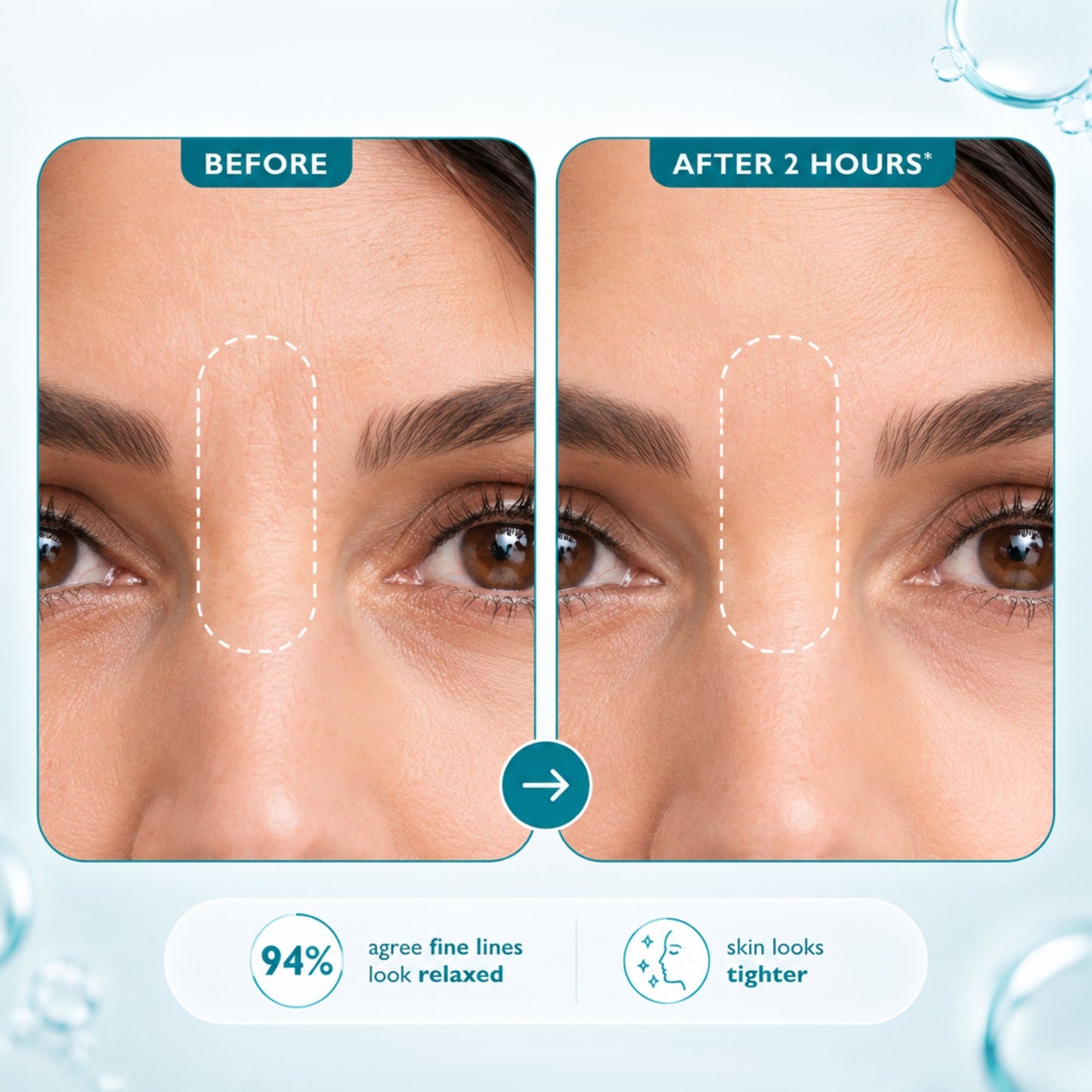 Peptide Skinjection™ Peptide-Infused Face & Eye Tape